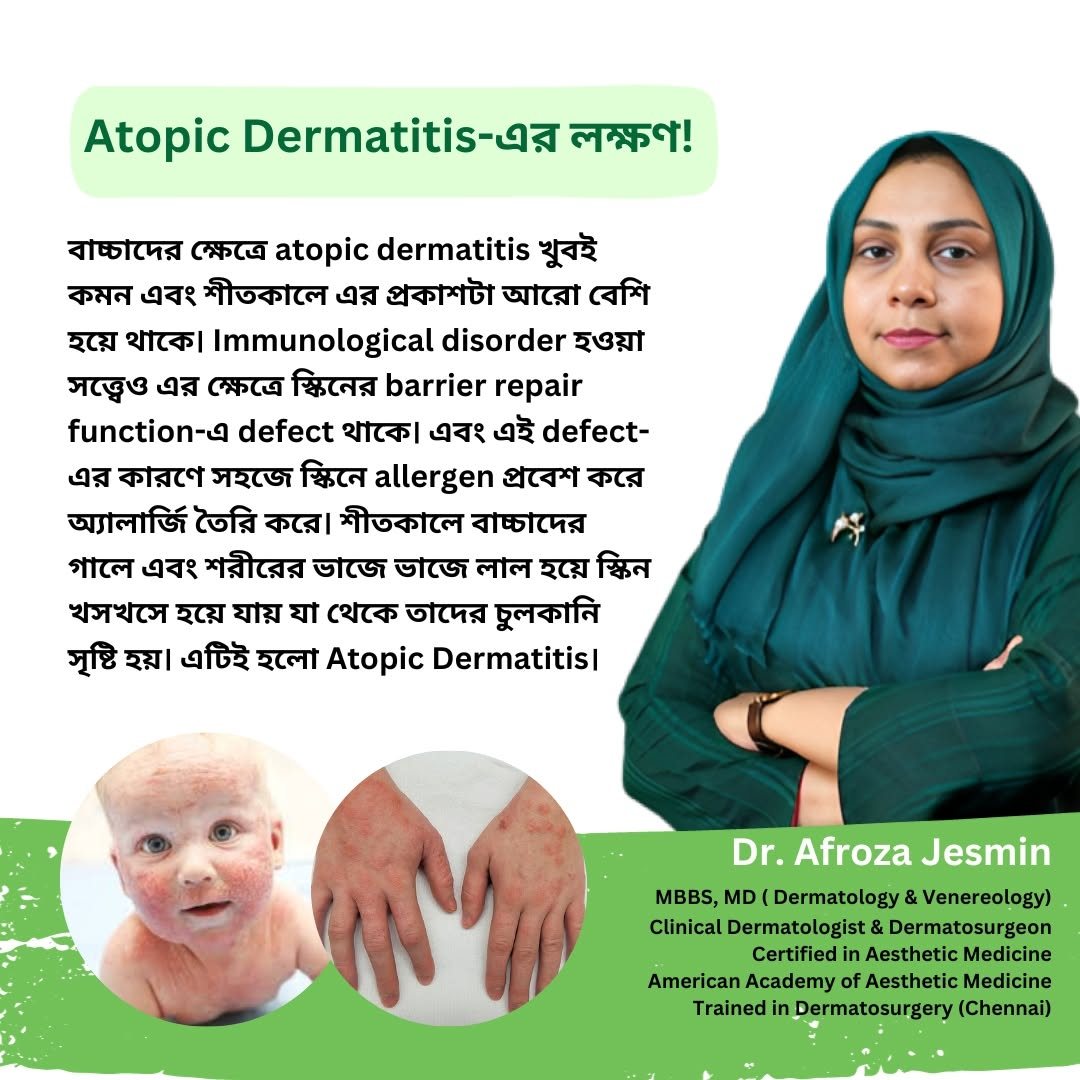 Dr. Afroza Jesmin explaining the signs of atopic dermatitis in children