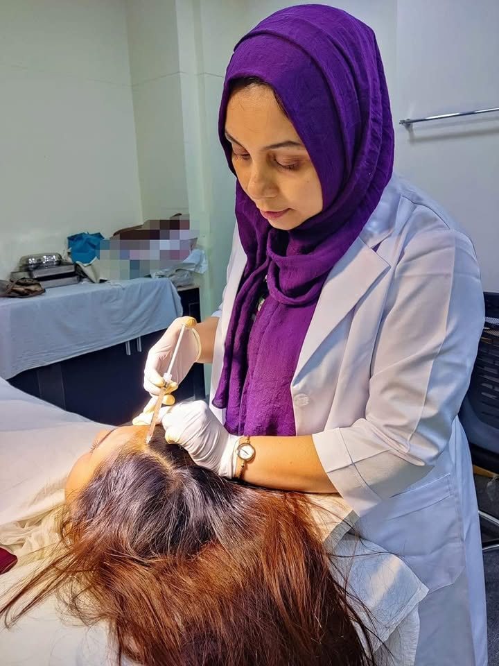 PRP for Hair Loss